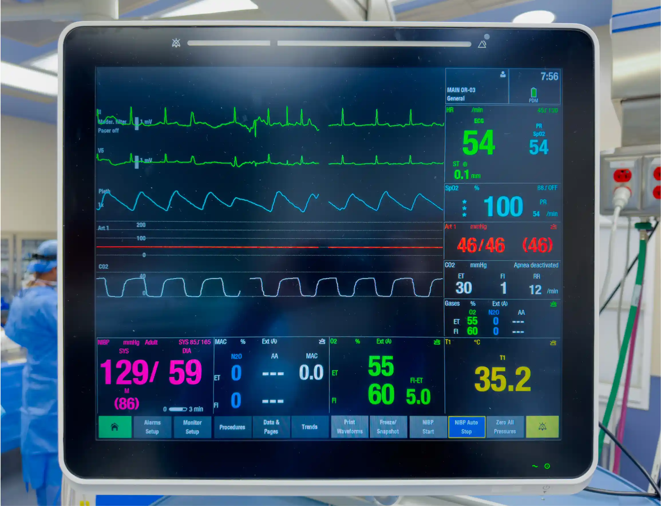 What Is a Holter Monitor Test and Why Might You Need One