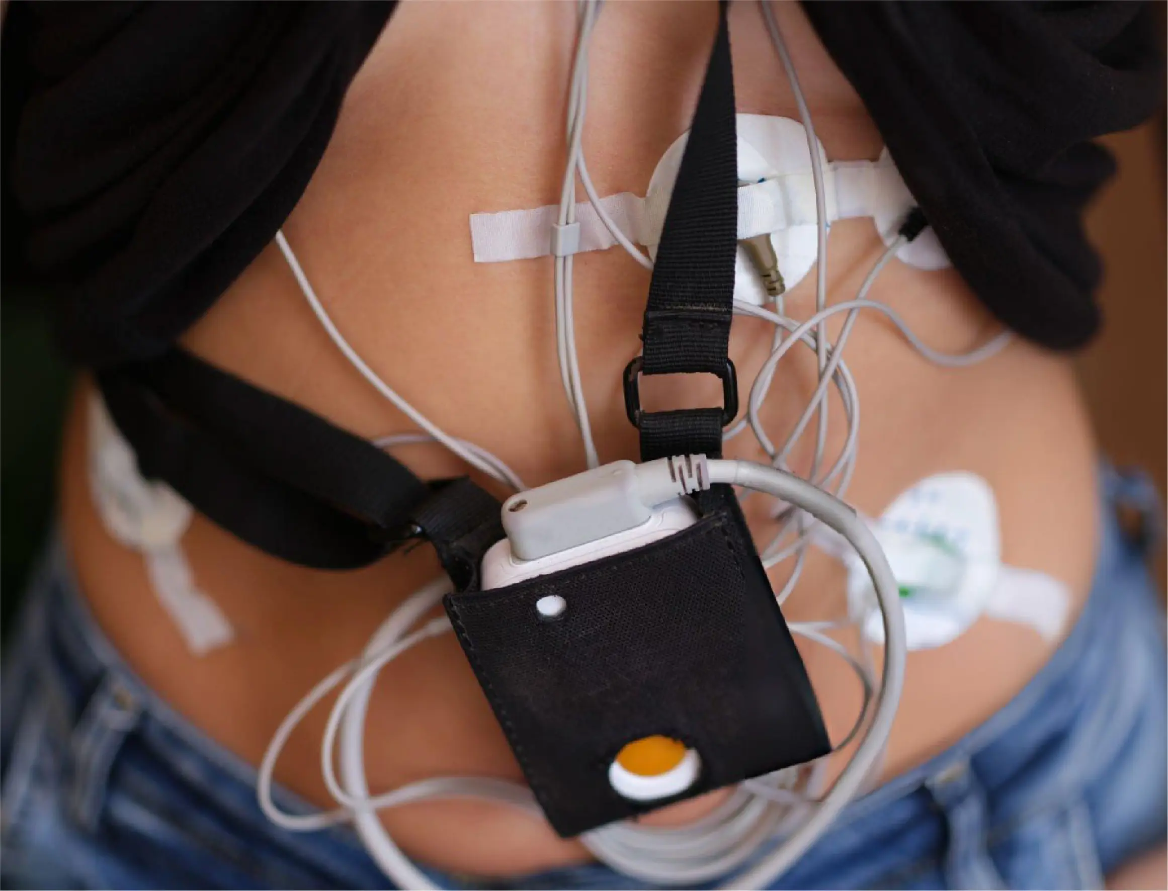 HopeMedical-Holter Monitor-Images-02