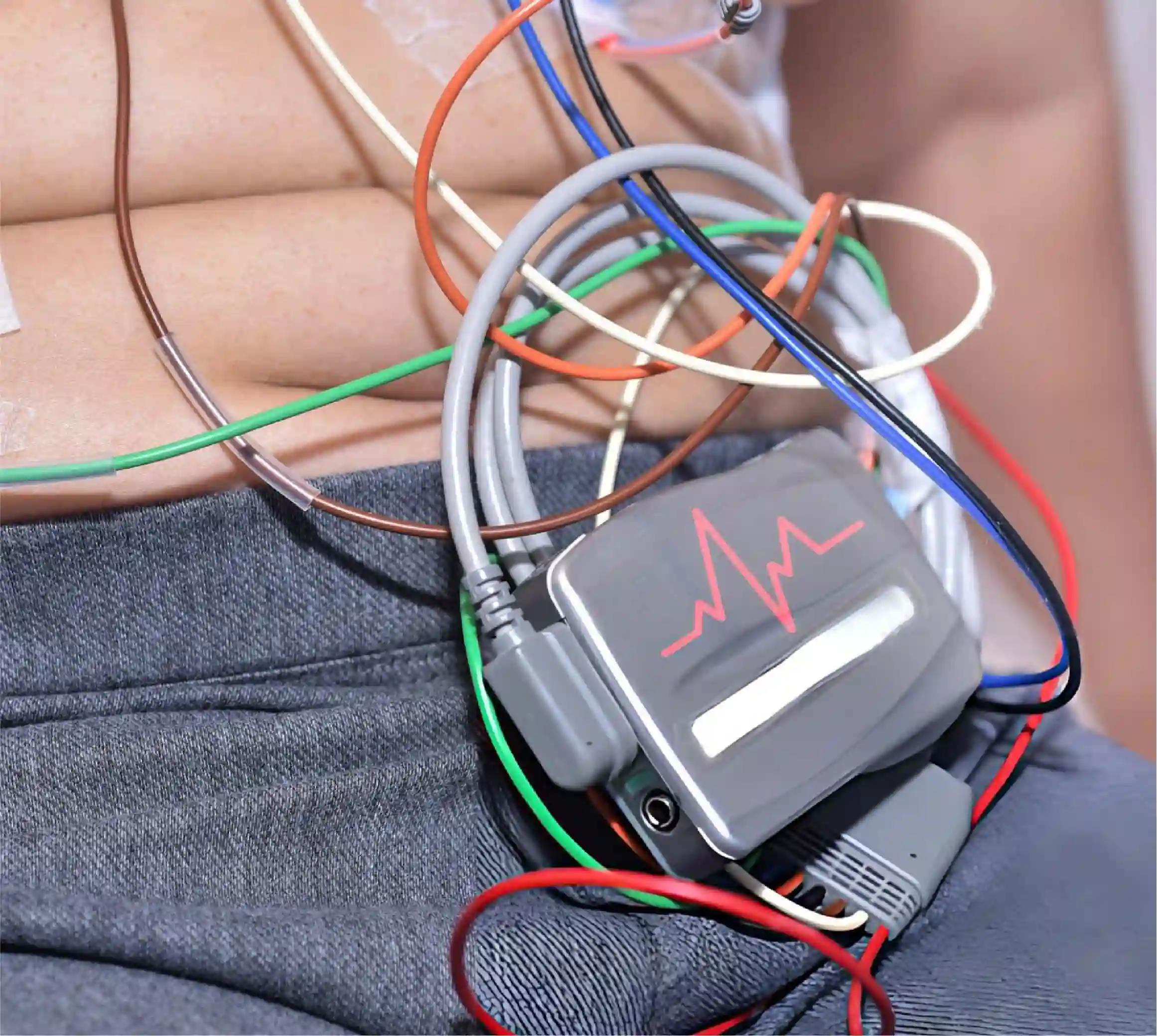 HopeMedical-Holter Monitor-Images-03