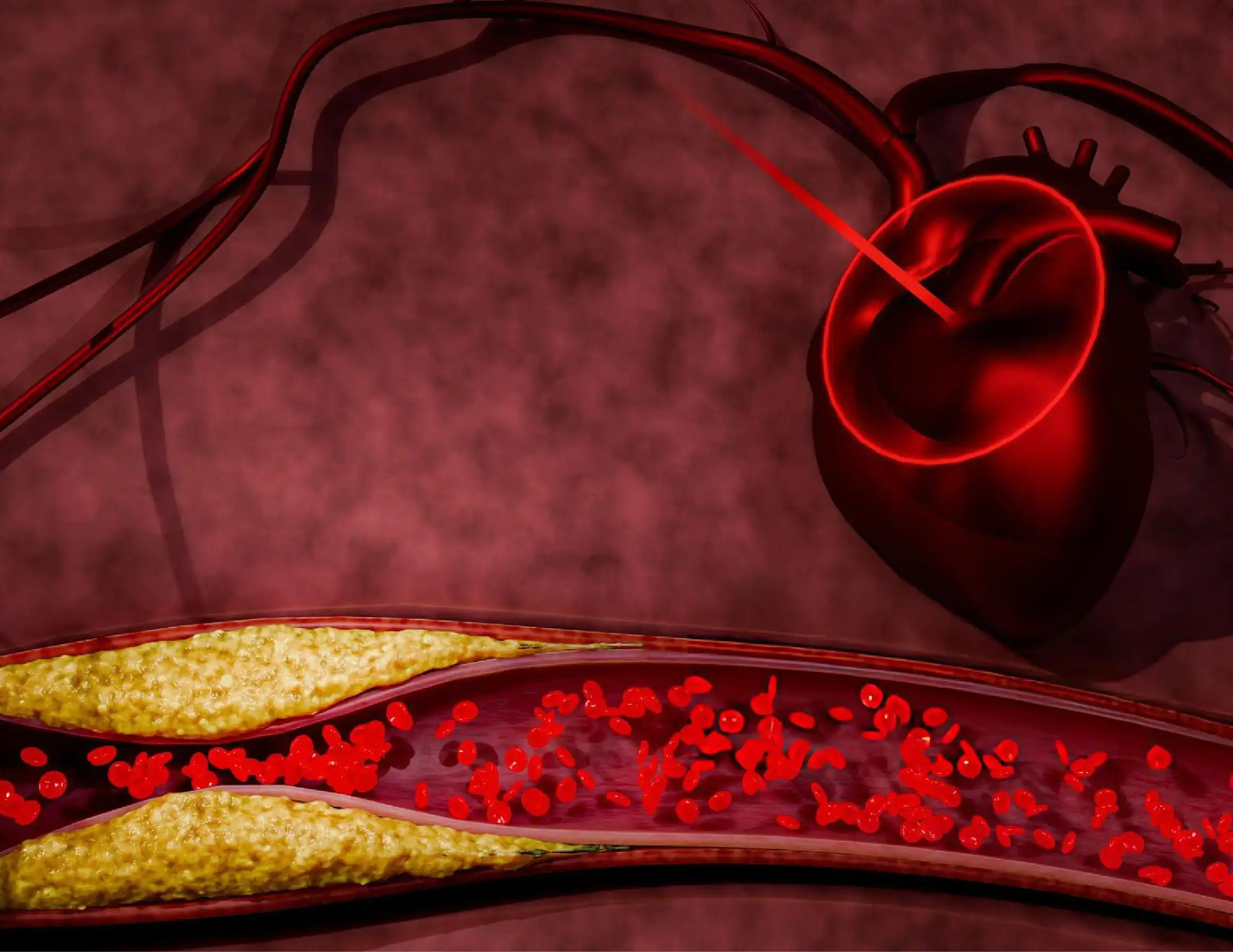 HopeMedical-Hyperlipidemia-Image-01