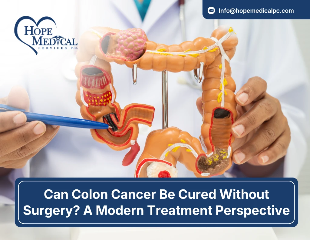 Can Colon Cancer Be Cured Without Surgery A Modern Treatment Perspective